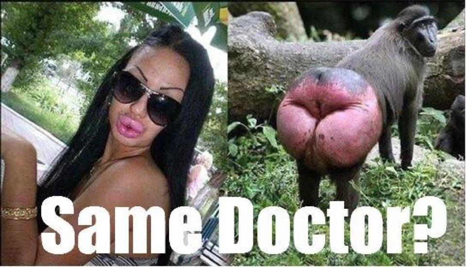 funny-photo-duck-lips-look-like-monkeys-ass.jpg