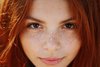 home-remedies-to-get-rid-of-freckles.jpg
